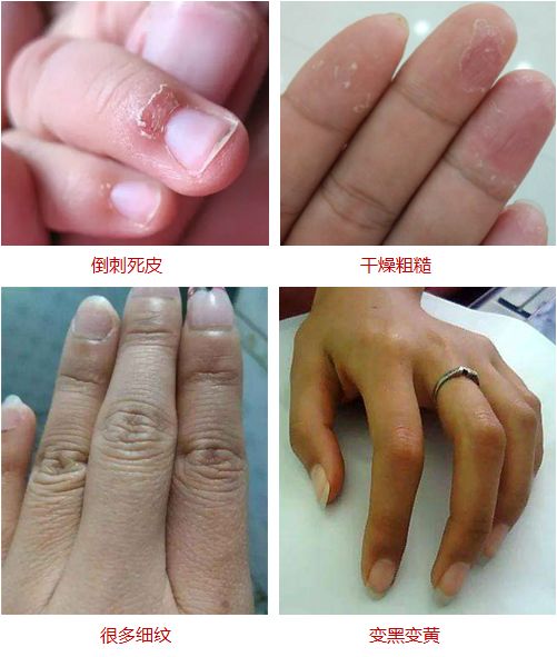 粗糙又脱皮的手适合什么手霜,润手霜改善粗糙细纹