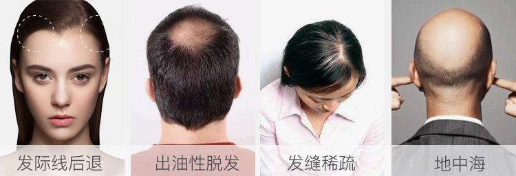 外用中药眼膜,中药眼膜去眼袋眼纹