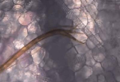 被蚊子咬了痒怎么快速止痒,被蚊子咬了挠痒动作