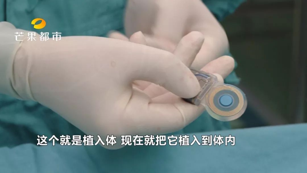 申请免费人工耳蜗自费还需要多少,山东儿童免费人工耳蜗申请流程