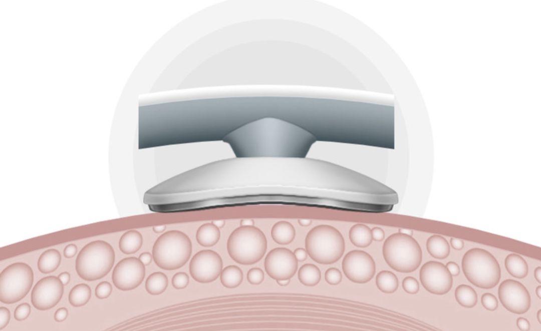 颈椎按摩仪推荐网红,明星同款肩颈按摩仪