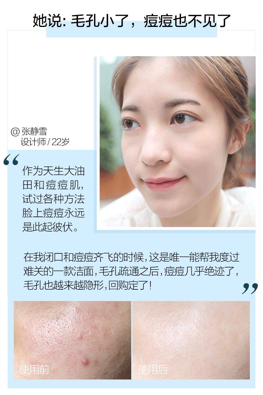 这样洗脸让你一步步毁容,这样洗脸让你皮肤越来越差