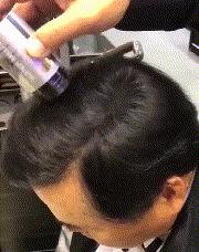 每天差不多掉多少头发算脱发,一天掉多少根头发算脱发