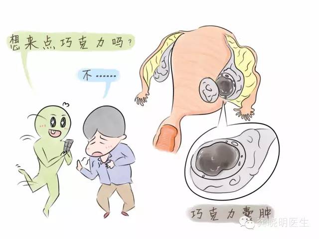 子宫内膜异位症——痛经的一种常见病因