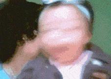 胳膊上的疤痕是怎样形成的,手臂上哪里的疤不容易被发现