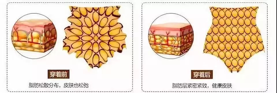 暖宫瘦身方法,暖宫暖胃瘦身衣