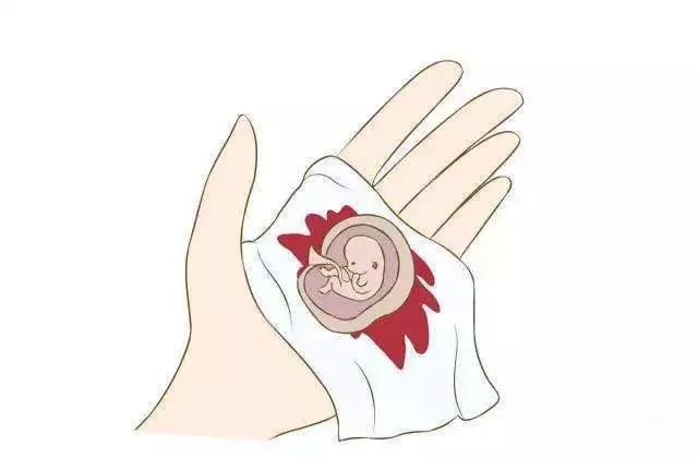 不同人流产,不同人群避孕方法的选择宣传册