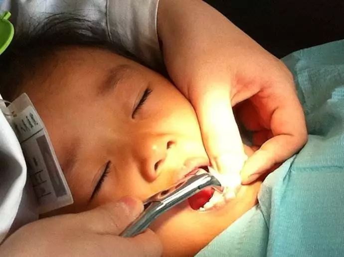 十大美白牙齿牙膏,美白去渍牙膏澳洲