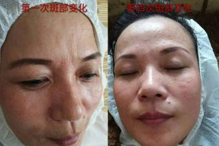 免费体验！女人做了变美，男人做了健康！在昌吉你还不知道就out了