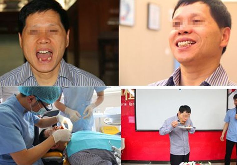 哪十家医院种植牙享受补贴,缺牙市民可申请免费种牙