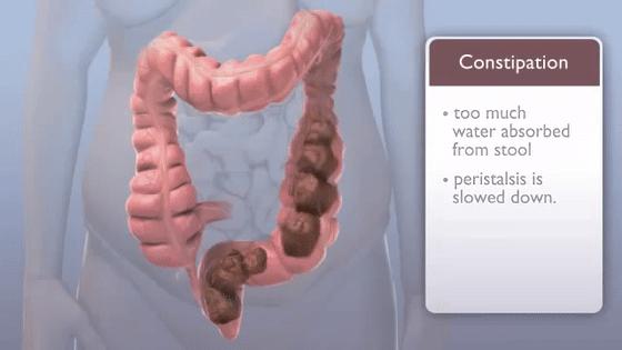 便秘是怎么回事能看好吗,便秘的表现与症状怎么解决
