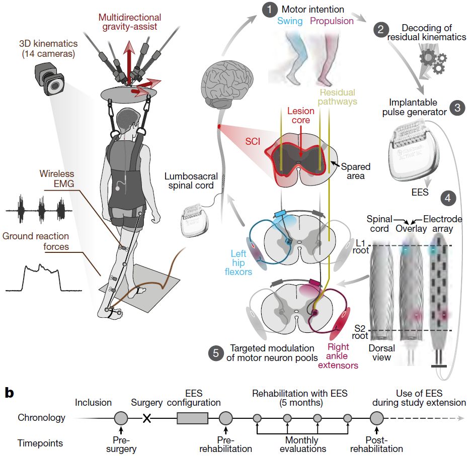 日本干细胞治疗脑卒中病人,日本干细胞治疗脊髓损伤的进展