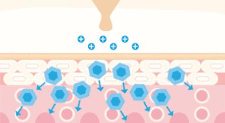 鼻尖挤出白色的是什么,鼻子上挤出的白丝怎么解决