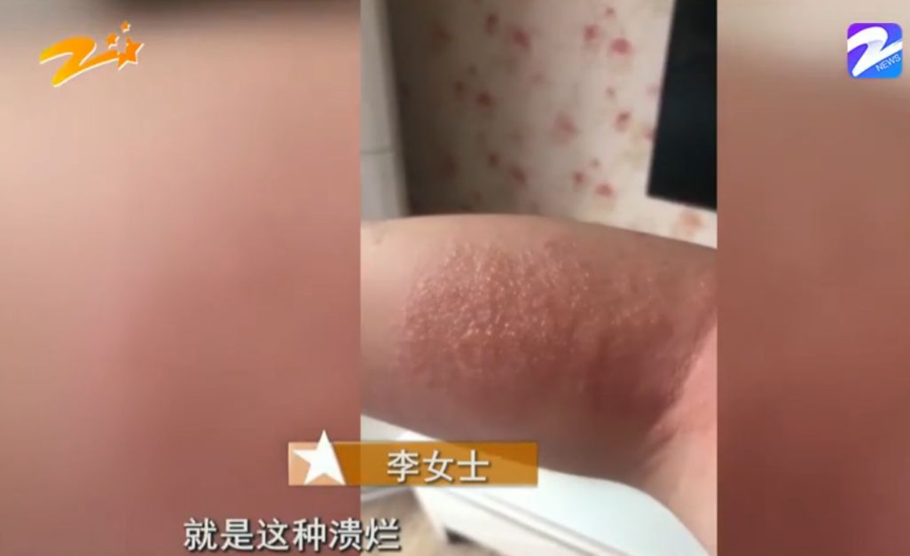 药浴排毒身上起几颗疙瘩,中医洗澡时全身抓出一条条红痕