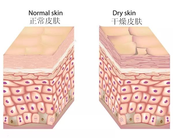 脸皮起皮干燥显老,脸皮松弛特显老怎么办