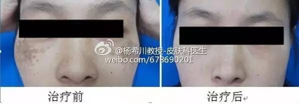 让你轻松告别色斑的困扰,告别暗沉淡化色斑