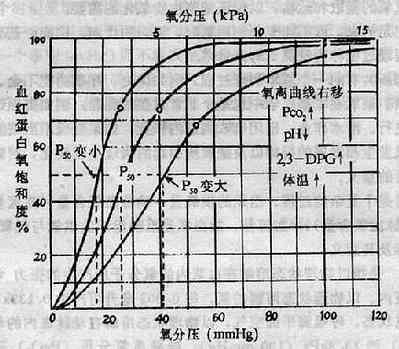 动脉血气分析常用部位图解,动脉血气分析一针见血视频