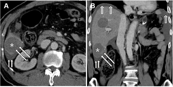 pubmed文献发表时间怎么看,pubmed文献检索实验报告