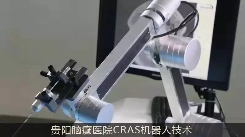 北京专家来渝会诊癫痫,北京市治疗癫痫病专家