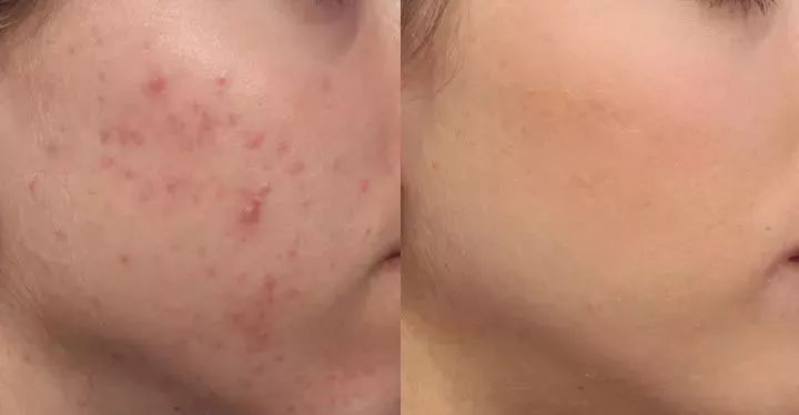 清凉止痒防暑醒神膏,止痒的草药膏