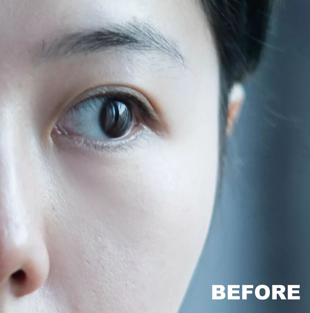 怎么对付闭口,终于找到了对抗失眠的良方