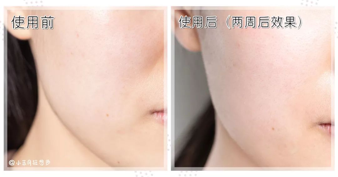 测评适合妈妈用的护肤品抗衰老,妈妈用的护肤品抗衰老测评