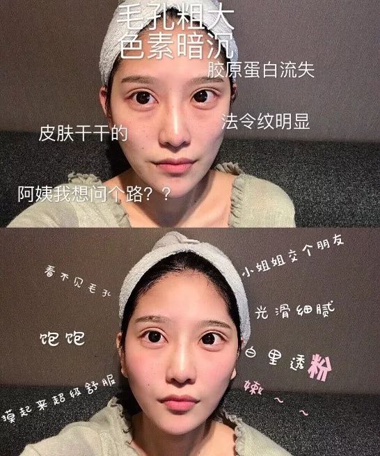 测评美容仪到底要买还是不买,美容仪到底选哪个款比较好一些