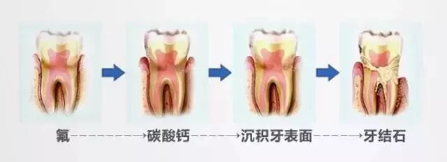 牙不好一般最大原因,牙齿越来越差的原因