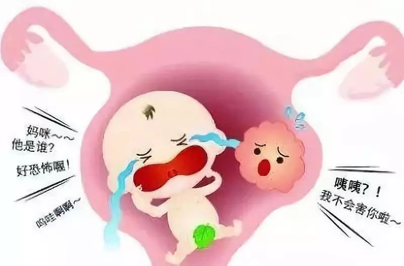 子宫肌瘤三件事,子宫肌瘤大包块