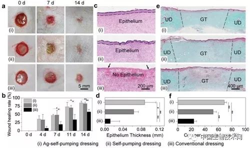 理化所亲疏水复合敷料用于促进伤口愈合研究获进展