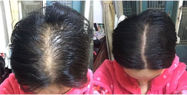 额前新长出的碎发怎么办,额前碎发长出来了