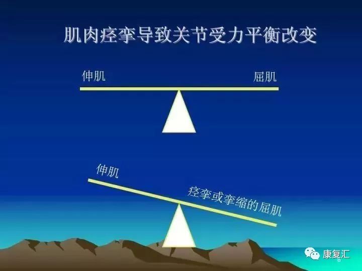 痉挛症可以治疗好吗,痉挛的康复