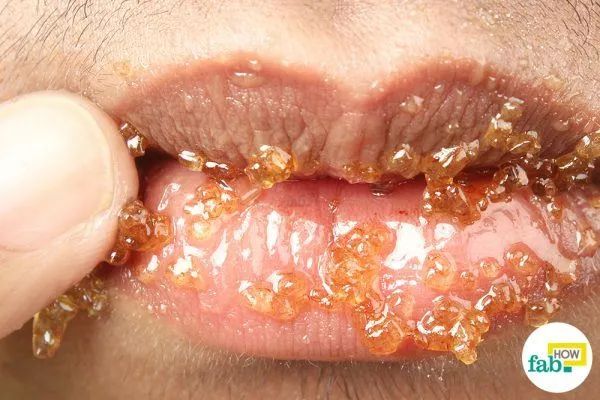 蜂蜜加白醋有什么效果,蜂蜜加白醋怎么样