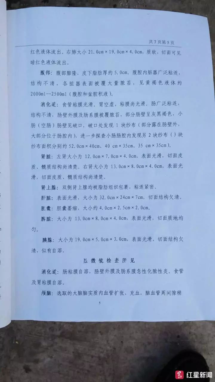 剖宫产手术取出孩子,剖腹取纱布