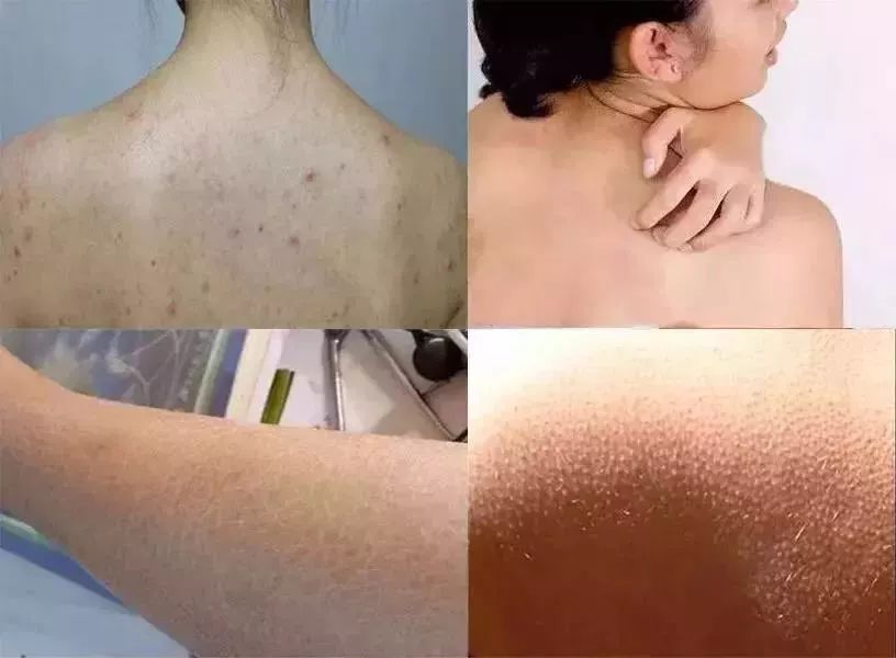 团购预告｜嫩出水、白成雪、滑溜溜的肌肤，靠这款身体乳就够了