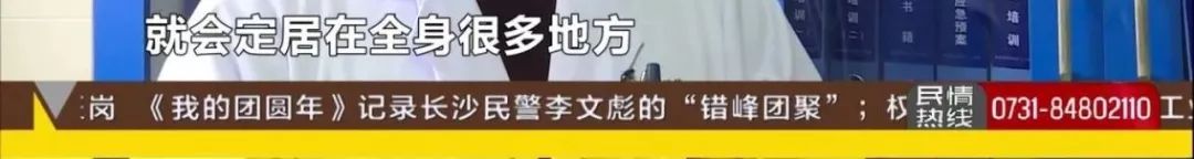 湖南一男子莫名全身乏力口齿不清，脑子里还有蠕动的……都是因为18年前吃了这个