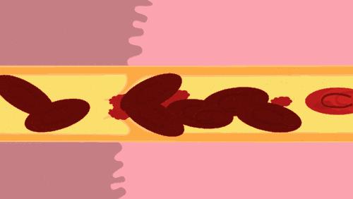 别再把炒菜废油倒水池了！后果很恐怖