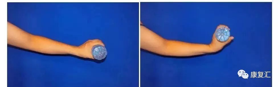 手指麻木刺痛,手指手术后麻木康复训练法