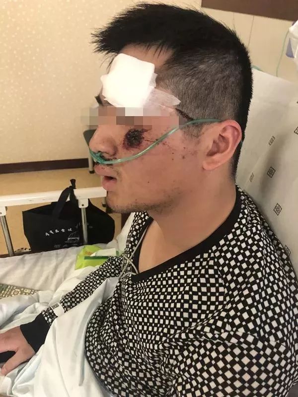 逃避交警检查冲卡逃跑违法吗,齐齐哈尔酒驾碾压辅警后续