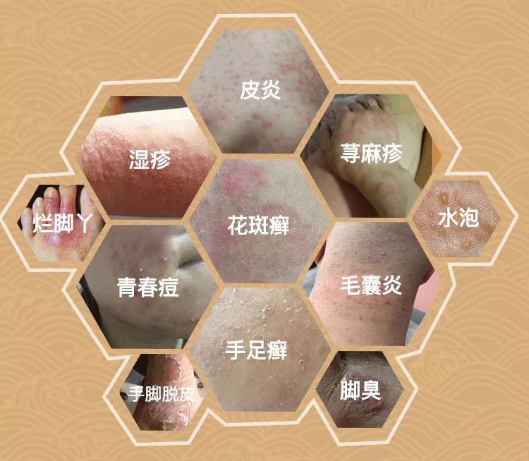 清凉止痒防暑醒神膏,止痒的草药膏