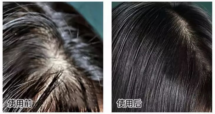 3天不洗头头皮特别多,3天不洗头头皮好臭