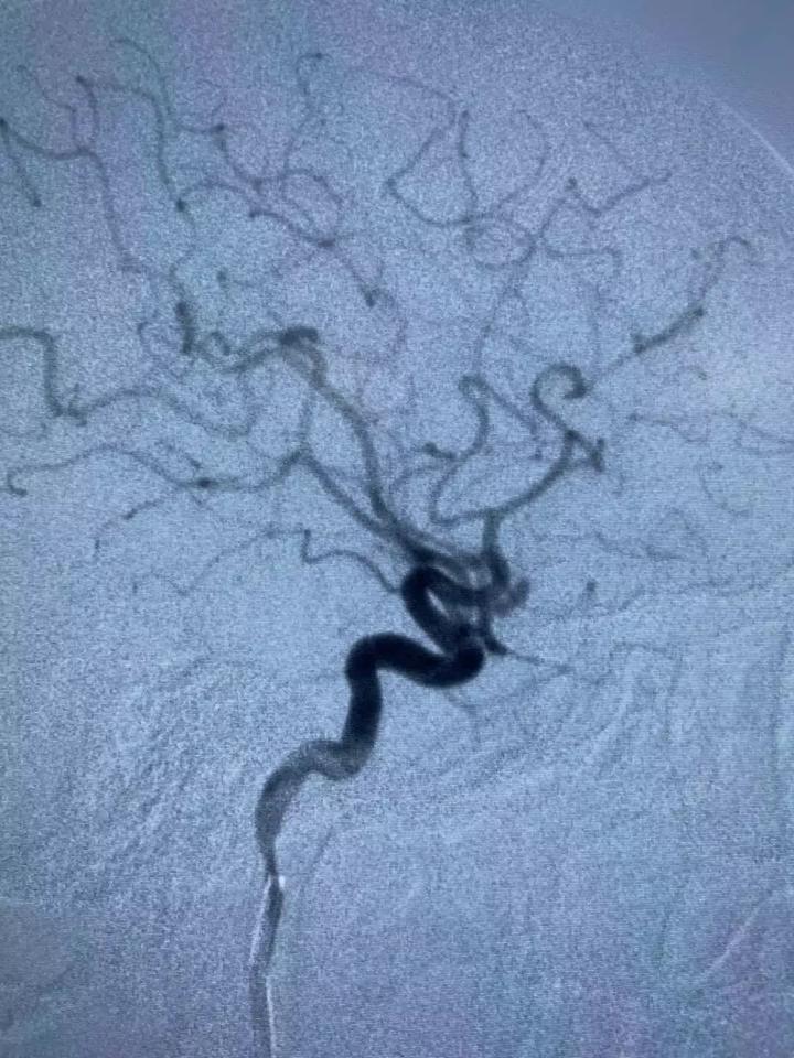 37岁男子被抢救4天,39岁男子被送医院抢救
