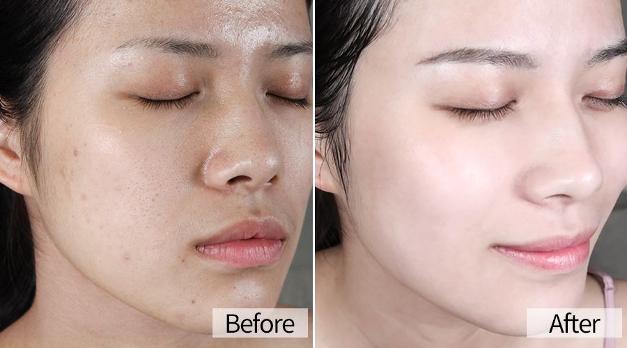 日本流行的美容方式是什么,日本推荐28天美容换脸法