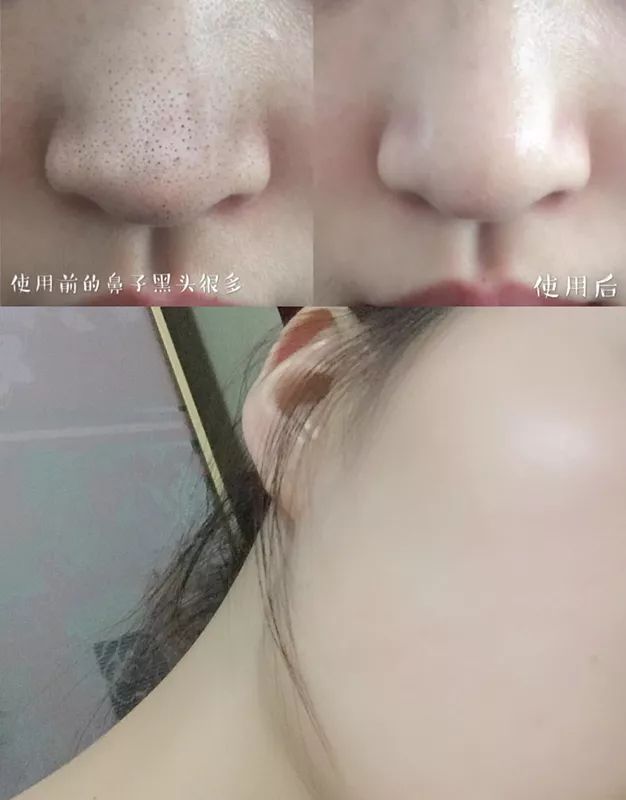 火山泥膜深层清洁面膜测评,嫩肤的白泥面膜评测