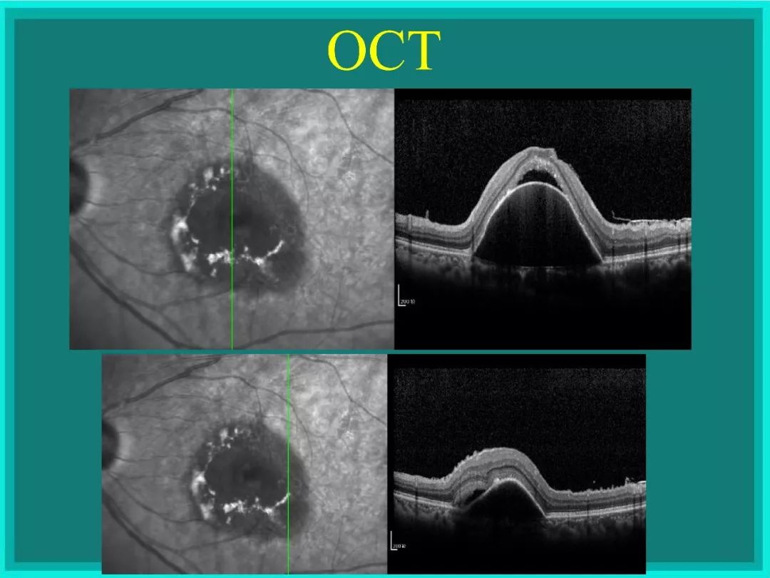 明者远见于未萌原文,明者远见于未萌解释