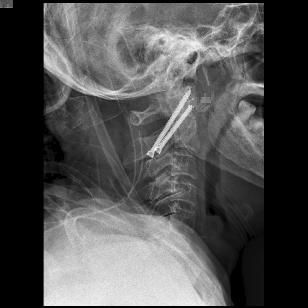 鍕囬棷鐢熷懡绂佸尯鍖婚櫌,鍕囬棷鐢熷懡绂佸尯浜旀鍙仠鎵嬫湳