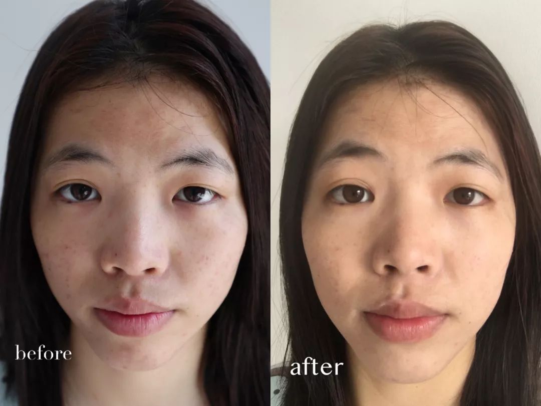 评测+浮力｜素颜皮肤差？揭秘新肌女孩的秘密*器武**