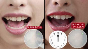 美白牙膏一刷就好,美白黄牙烟渍最好的牙膏