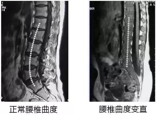 情人节福利,情人节福利秒杀