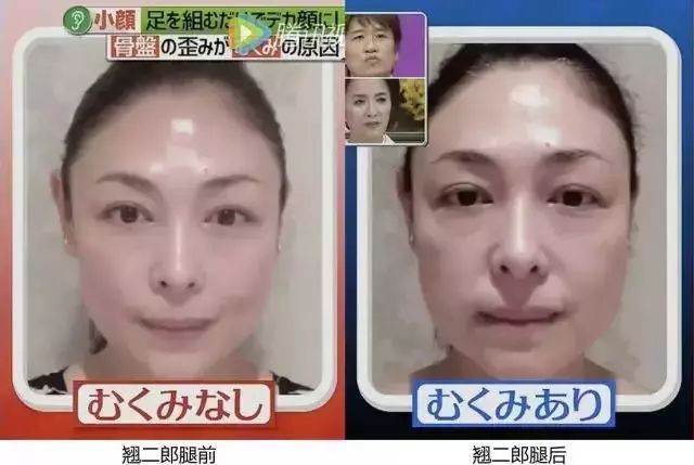 每天坚持10分钟瘦脸,每天坚持这三个动作帮你瘦身美体